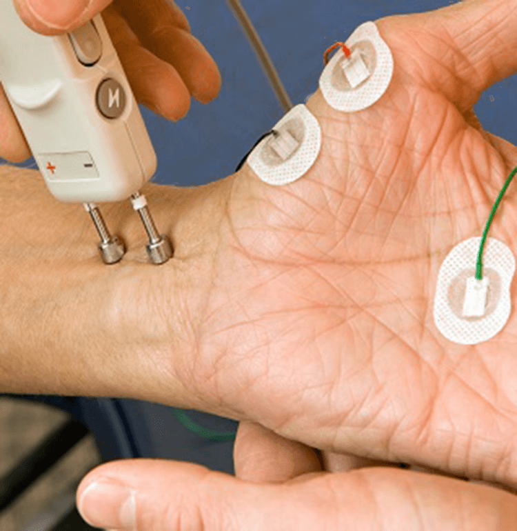 Electrodiagnostic Testing